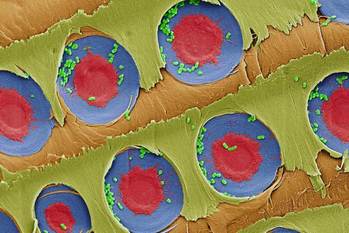 In this false-color image, E. coli bacteria (green dots) can be seen trapped around pit membranes (red and blue) in pine sapwood