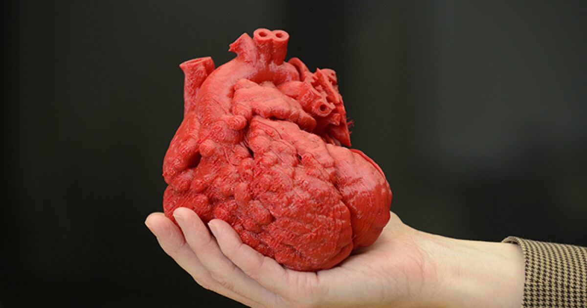 3D-printed heart helps doctors prepare for life-saving surgery