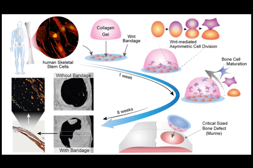 A diagram illustrating how the bandage helps heal broken bones