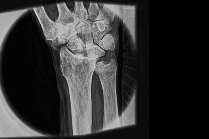 An X-ray of a human wrist demonstrates the system's ability to reveal soft-tissue structures and very fine detail (Photo: MIT)