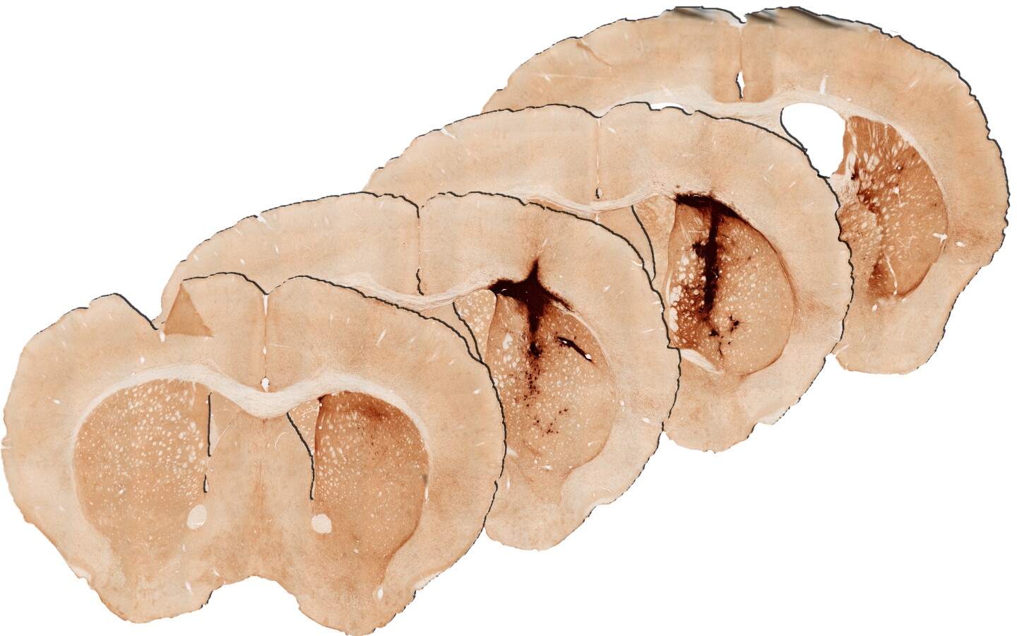 Effect of myoglobin-free hydrogel in mouse brain after 28 days