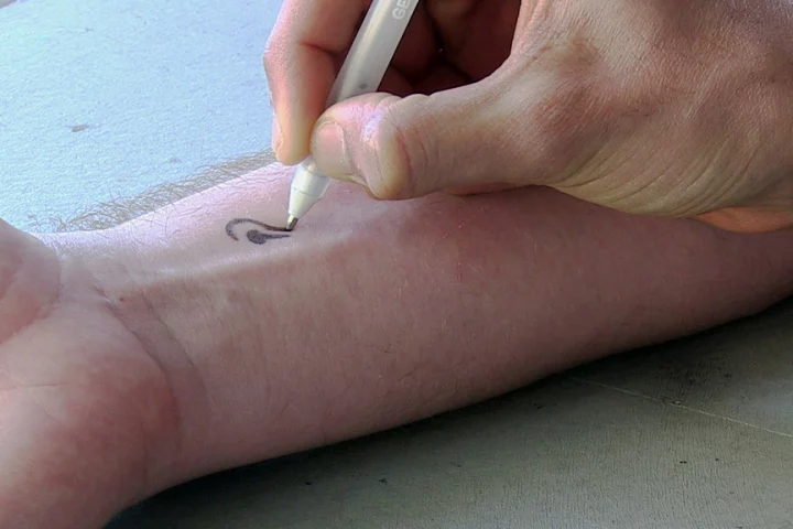 A glucose sensor is drawn onto a test subject's skin, using one of the bio-inks (Photo: UC San Diego)