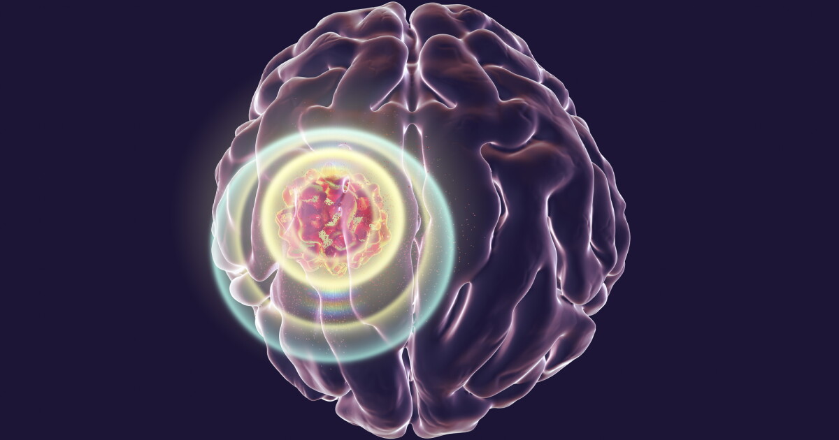 Infrared implant between skin and skull helps kill brain cancer Infrared implant between skin and skull helps kill brain cancer