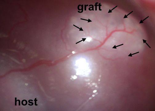 One of the renal organoids, implanted in a lab rat host (Image: Dr. Christodoulos Xinaris)