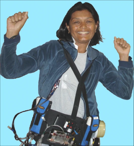 A patient models the Wearable Artificial Kidney prototype - the final product is intended to be smaller and worn under clothing.