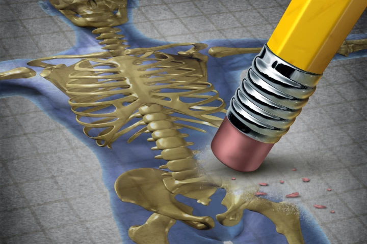 The hormone kisspeptin has been shown to help restore the balance between bone-building and bone-degrading cells