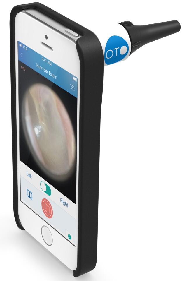 The Oto HOME package consists of an iPhone 5/5s-compatible case, and an otoscope attachment that mounts on that case, over top of the phone's camera