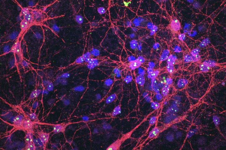 Snapshot of the lab-grown cell culture establishing its neural network