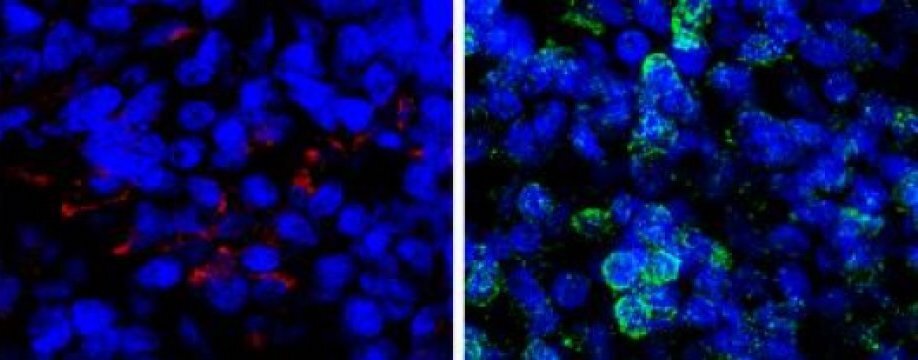 Human mini-brains before and after a dose of the psychedelic 5-MeO-DMT, with affected proteins fluorescing