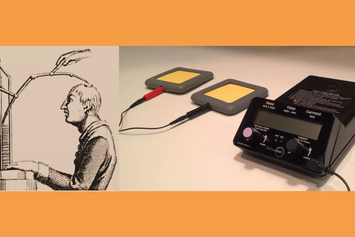 tDCS has come a long way from Giovanni Aldini's 1802 pioneering treatment of Luigi Lanzarini's major depression (left) to a compact modern tDCS apparatus (right) (Photo: johnboy6785)