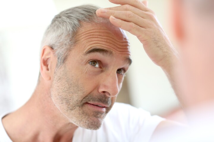 Scientists are one step closer to understanding why hair grays with age