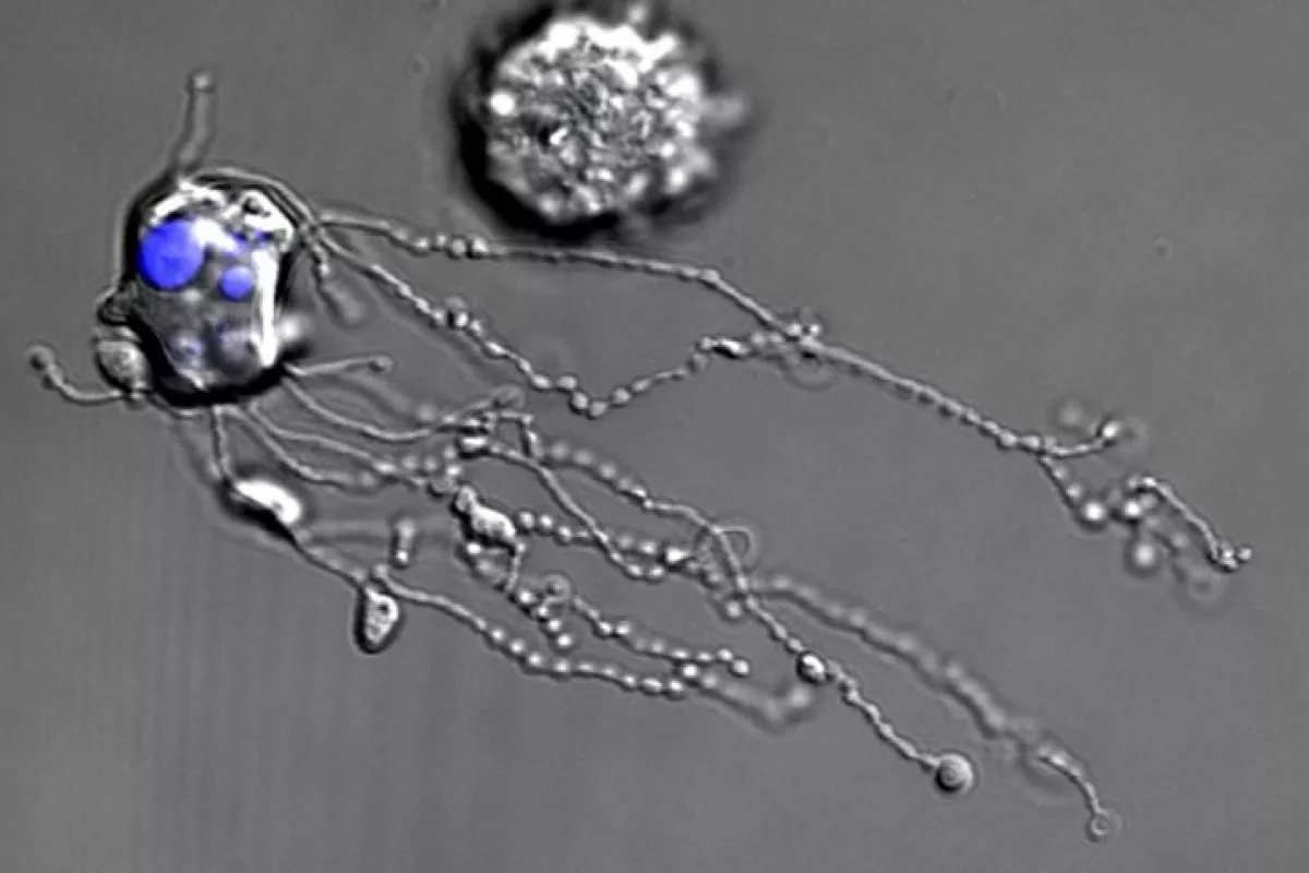 The first-of-its-kind video shows the white blood cells to eject a string of proteins as they die
