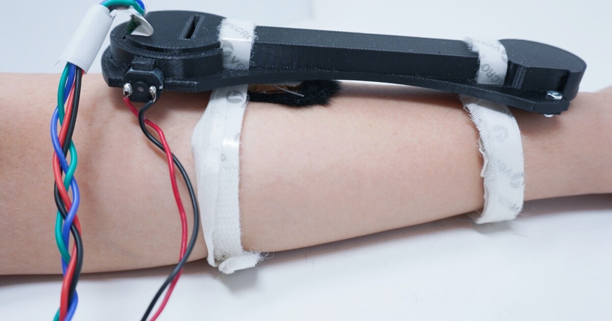 Armstroking wearable found to reduce perceived stress and anxiety