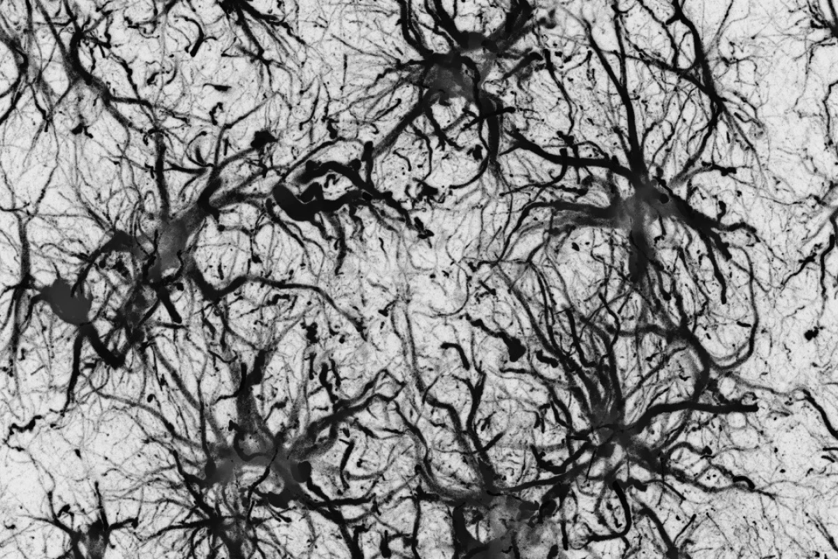 The cortex of an animal model of Alzheimer's disease