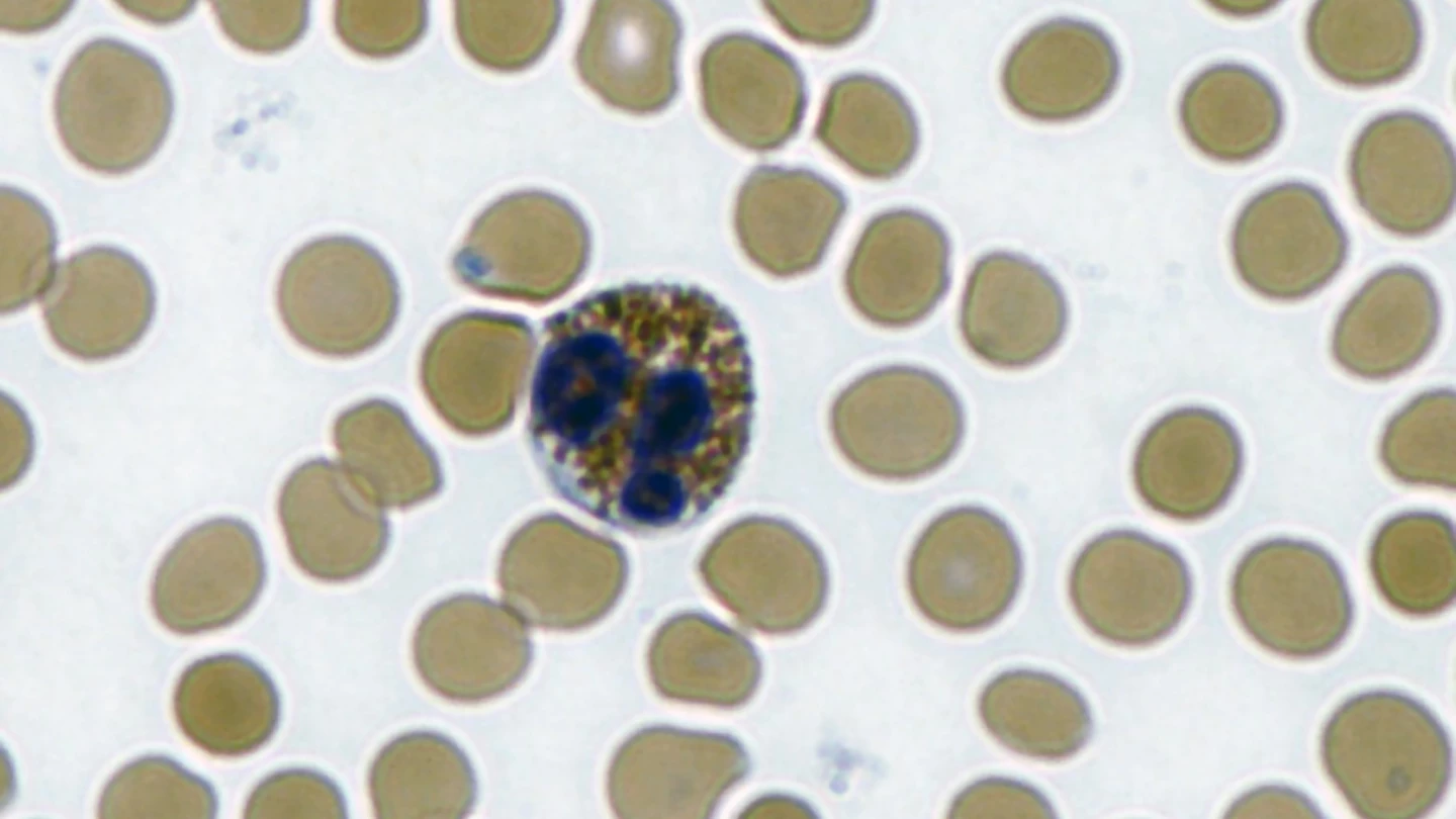 An eosinophil, the large stained cell in the middle of the image