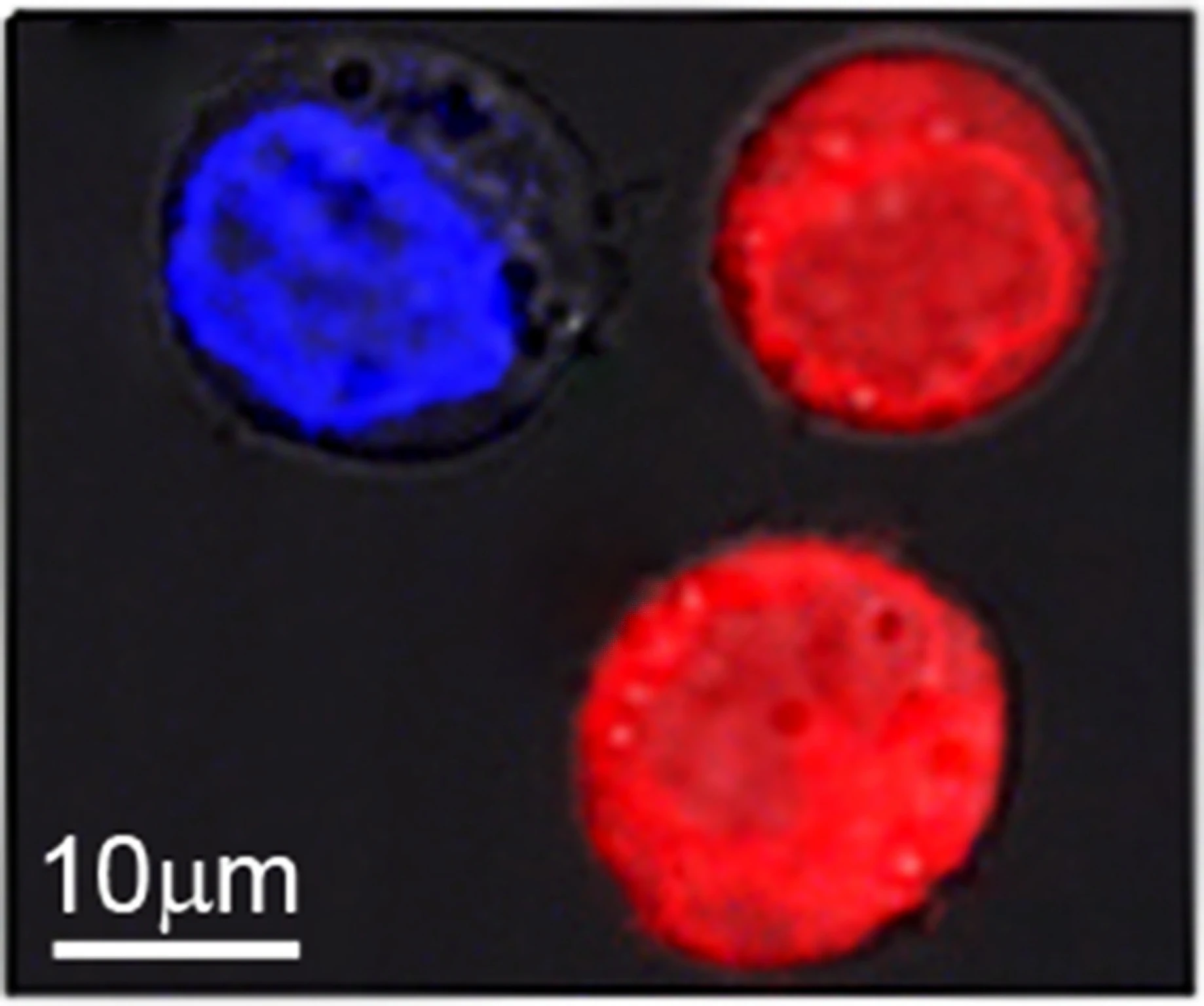 Identical cells stained red and blue were the target of research at Rice University to show the effect of plasmonic nanobubbles. The bubbles form around heated gold nanoparticles that target particular cells, like cancer cells. When the particles are hollow, bubbles form that are large enough to kill the cell when they burst. When the particles are solid, the bubbles are smaller and can punch a temporary hole in a cell wall, allowing drugs or other material to flow in. Both effects can be achieved simultaneously with a single laser pulse. (Credit: Plasmonic Nanobubble Lab/Rice University)