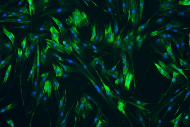 Human ureteral cells, grown in the lab