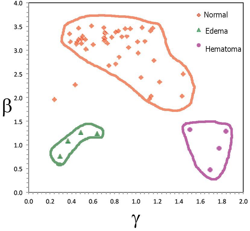Correlations illustrating the ability of the VEPS brain injury sensor to differentiate normal, diffuse TBI, and local TBI patients (Image: C. Gonzales via PLOS ONE)