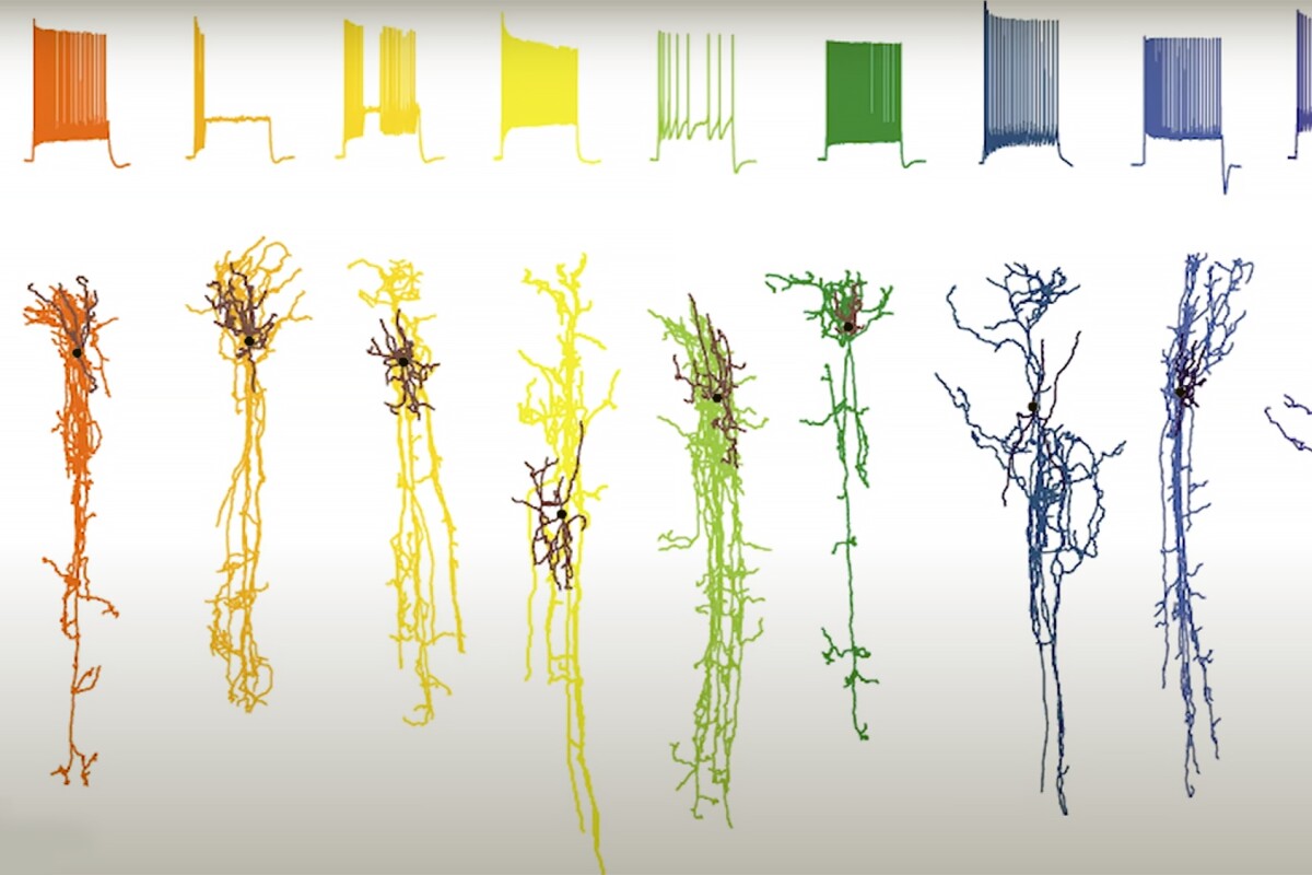 Researchers have created a 'pathology clock' of how brain cells are damaged by Alzheimer's disease over time