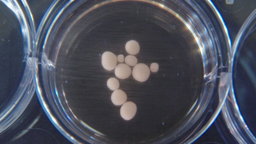 The mini-brains grown in the lab are about the size of peas