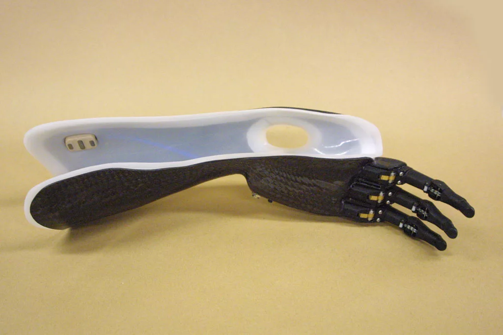 The Touch Bionics ProDigits bionic finger