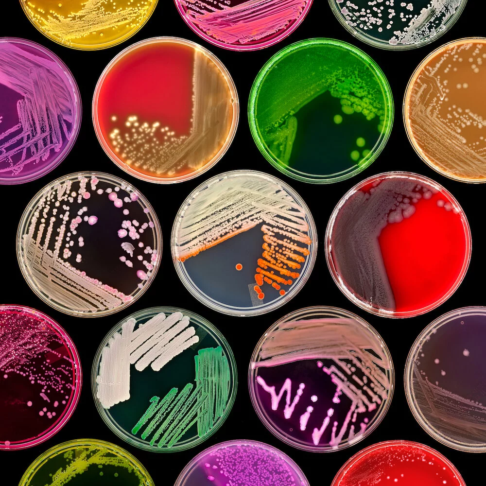 Culture Plates by Norm Baker was a finalist in the Plants & Fungi category of the 2020 Close-up Photographer of the Year. It highlights some of the amazing fluorescent patterns that can be created with microbes in Petri dishes.