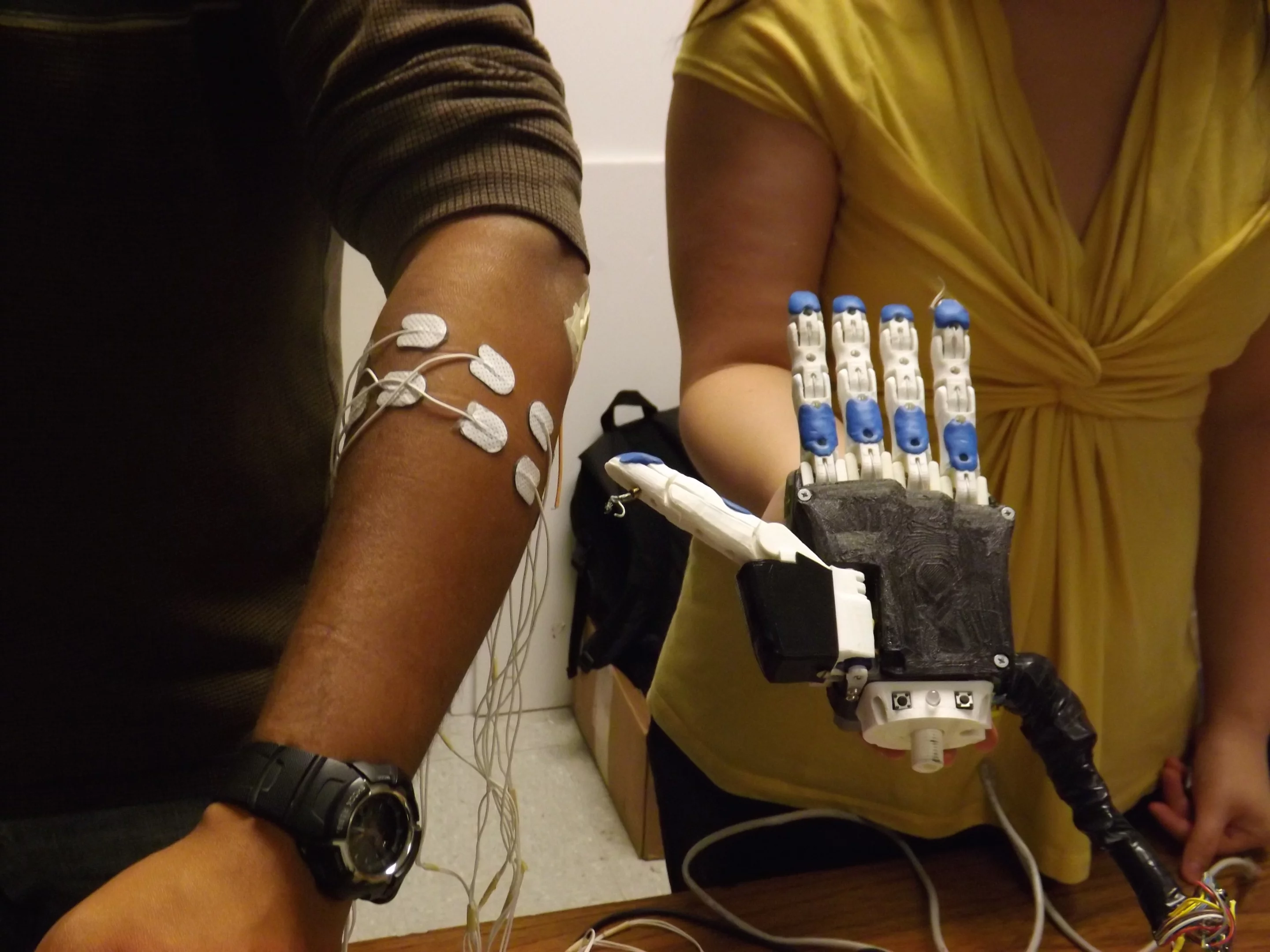 A US$270 programmable, 3D-printed electromyographic prosthetic hand may soon change the lives of amputees in Ecuador and elsewhere around the world (Photo: University of Illinois at Urbana-Champaign)
