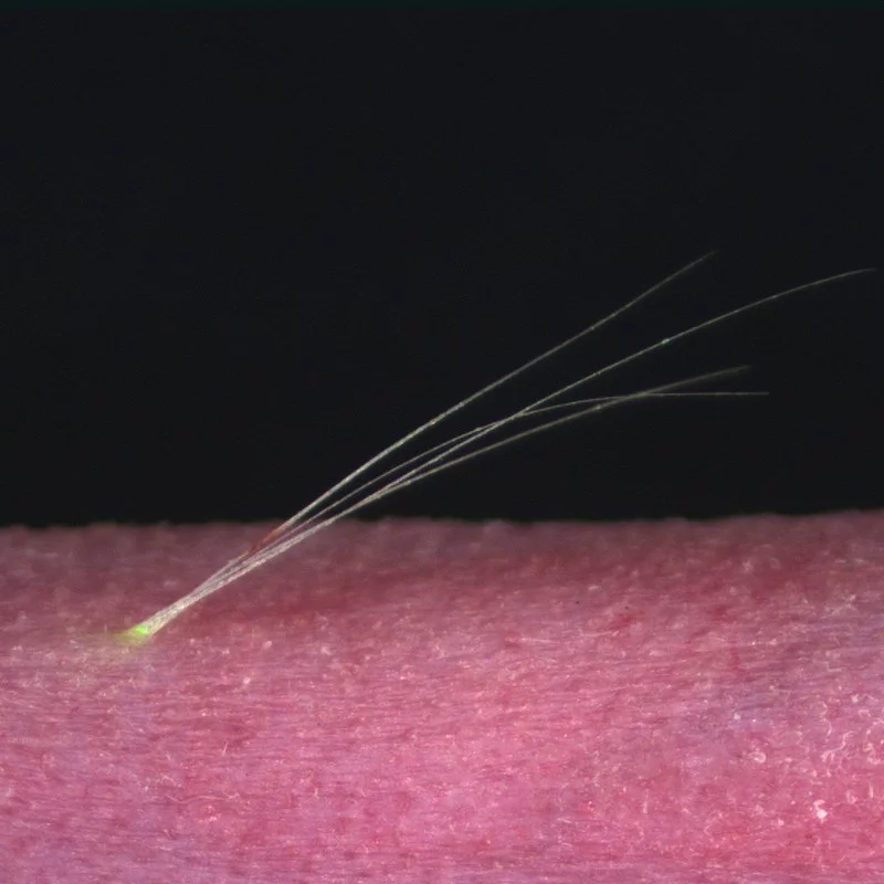 The observed growth of bioengineered hairs