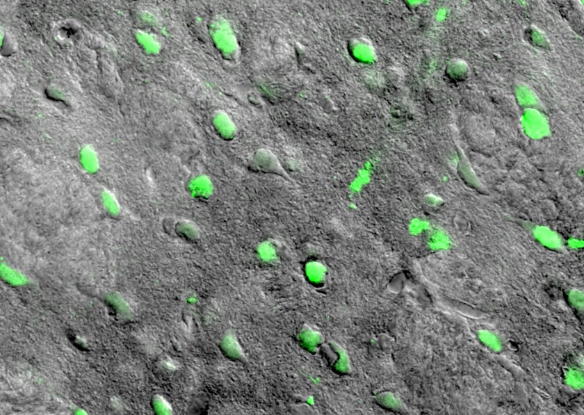 This transmitted light image shows sections of neural cells in the striatus that have been targeted for magnetic stimulation, in this case causing the mice to turn around
