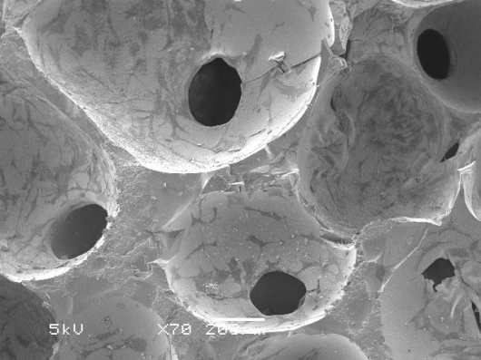 Bone cells grown on bioactive glass after two weeksImage courtesy Imperial College