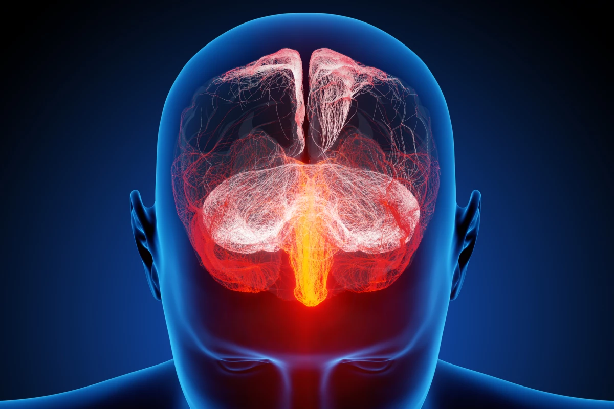 A new study has found a link between the build-up of damaging toxic proteins and the presence of neuroinflammation in three different types of dementia