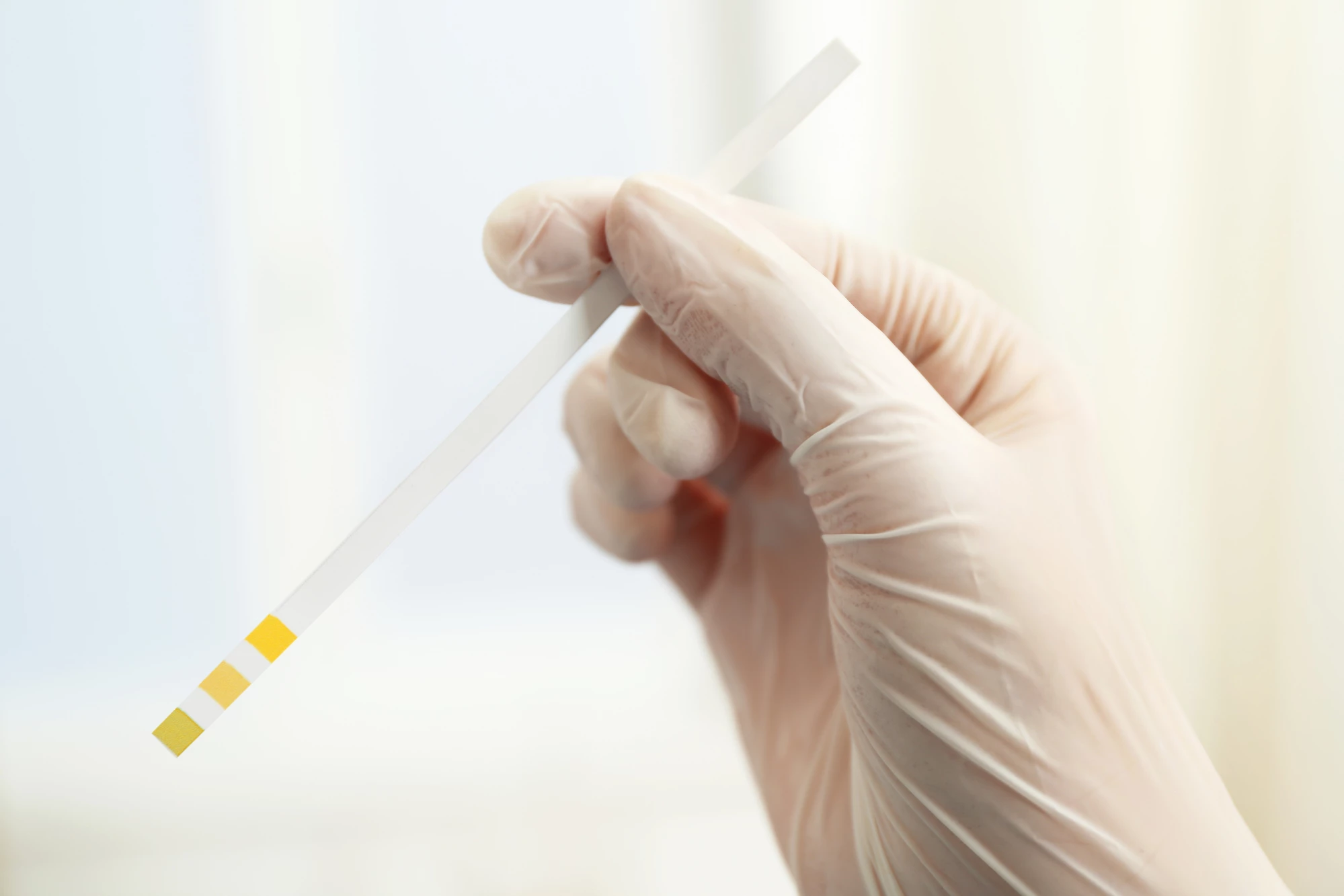 A disposable test strip similar to this one could alert users to serious rates of muscle loss