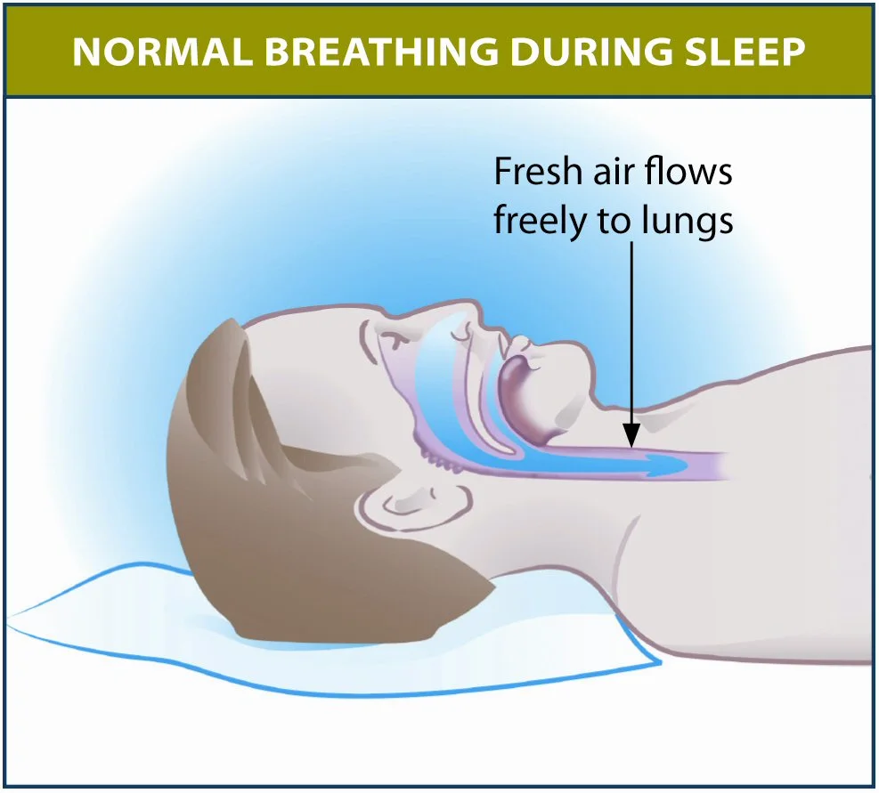 Diagram showing normal breathing during sleep