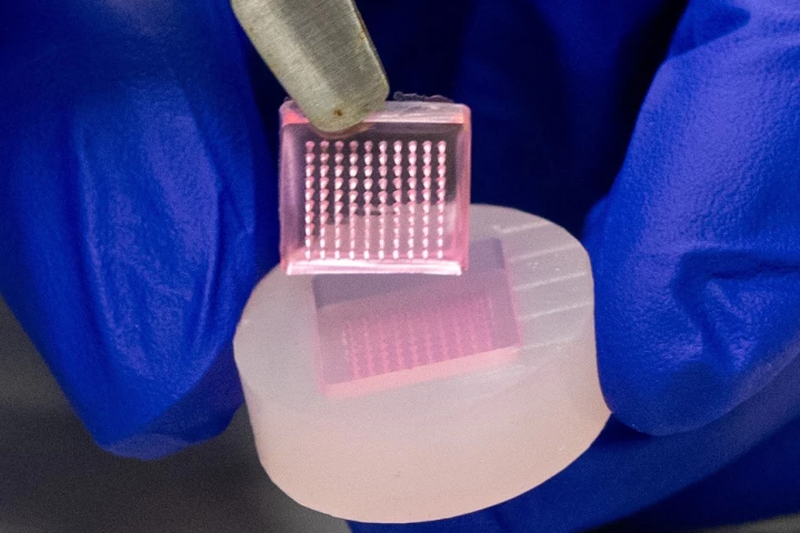These tiny needles could be the key to treating chronic wounds that many diabetics suffer from – and help them avoid amputations