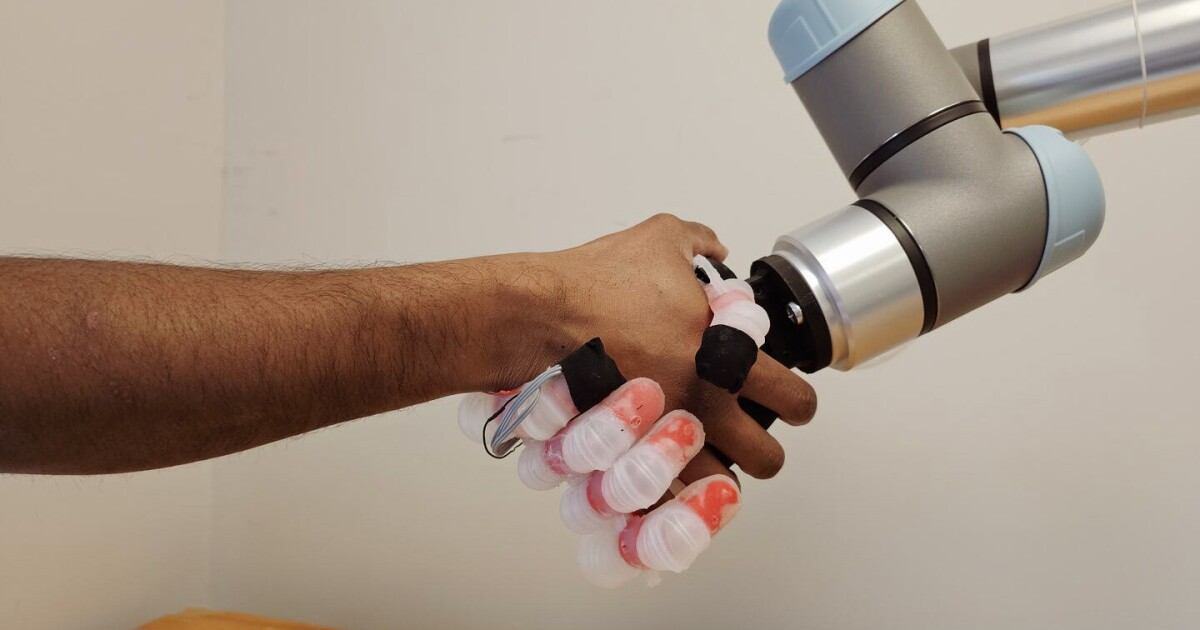 Prosthetic hand knows exactly how hard it can safely squeeze stuff Prosthetic hand knows exactly how hard it can safely squeeze stuff