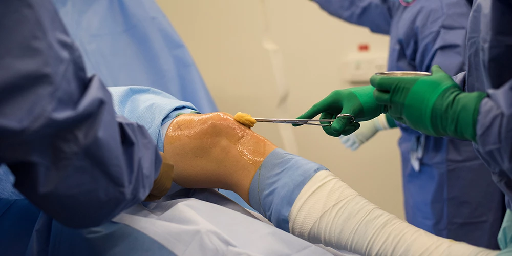 Scientists implanted grafts formed by cultured nasal cartilage cells into the knees of osteoarthritis sufferers, with promising results