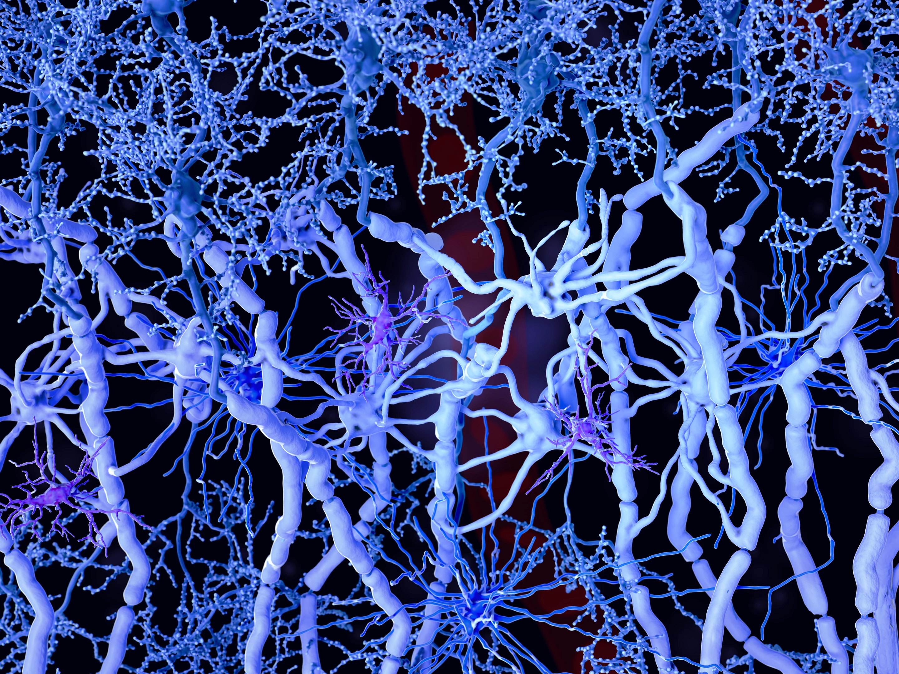Scientists have found that within the brain's white matter, which is made up of myelinated axons, a specific kind of cell death can accelerate cognitive decline