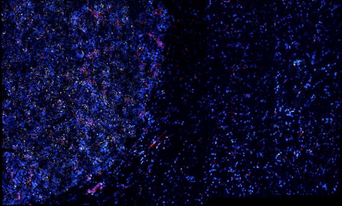 Golden nanostars, seen here as white dots, tend to accumulate in tumors (left), and not as much in healthy tissue (right), allowing researchers to target their attacks more precisely