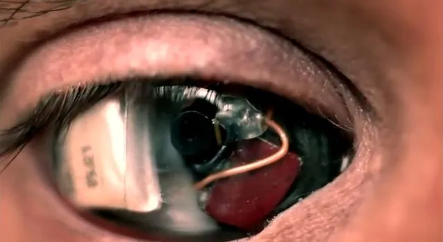 Film-maker Rob Spence has announced that his 'Camera Eye' is now fully functioning (Image: Rob Spence)