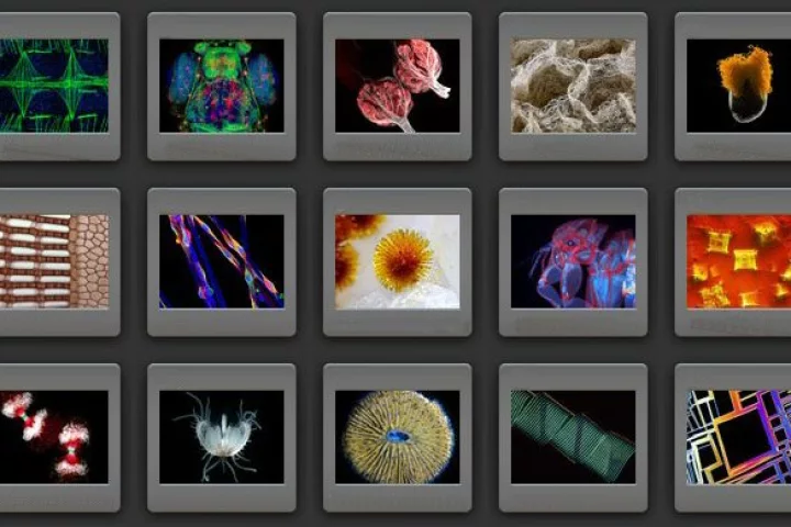 The winners of the 36th Nikon Small World Photomicrography Competition have now been announced
