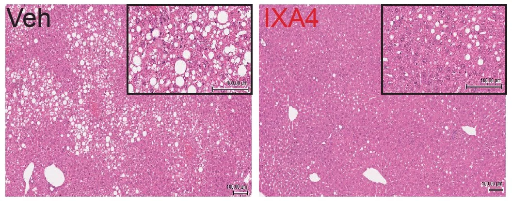 Liver fat deposits seen in untreated mice on the left, compared to mice receiving an experimental compound on the right