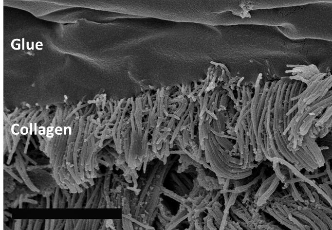 A close look at how the collagen in the heart tissue bonds with HLAA (Image: Pedro del Nido, Boston Children's Hospital)