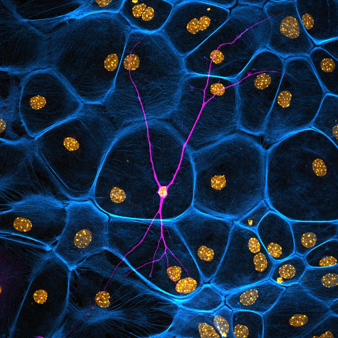 Image of Distinction. Single neuron in a field of non-differentiated mouse neural stem cells