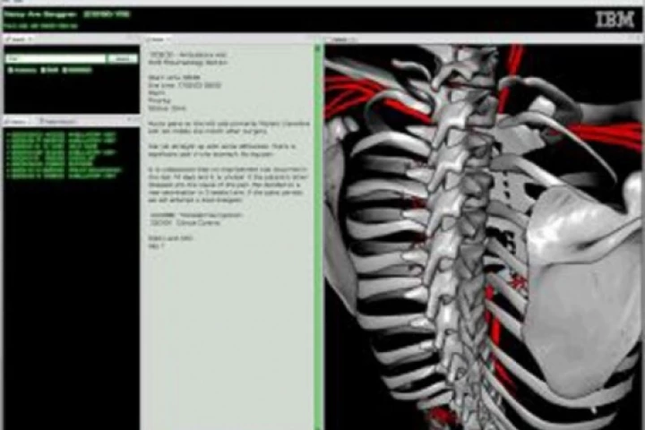 IBM medical visualization software that lets doctors search specific parts of the body