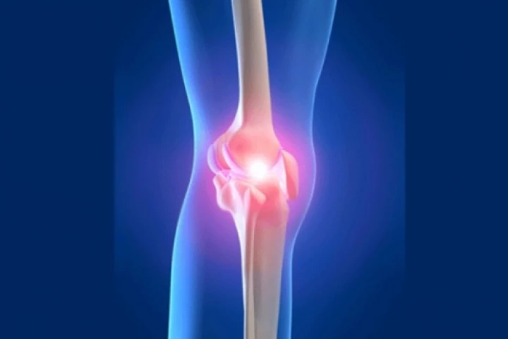 The new scaffold mimics bone and cartilage when implanted into a joint