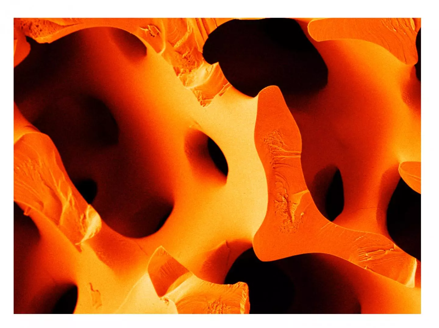 A close examination of the structure of sea urchin spines inspired researchers to find a way to create a new, more flexible type of cement