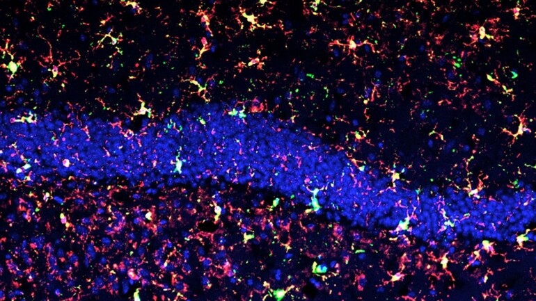 Reactive microglia (red+green) in irradiated mouse hippocampus – blue stain is cell nuclei for anatomical reference