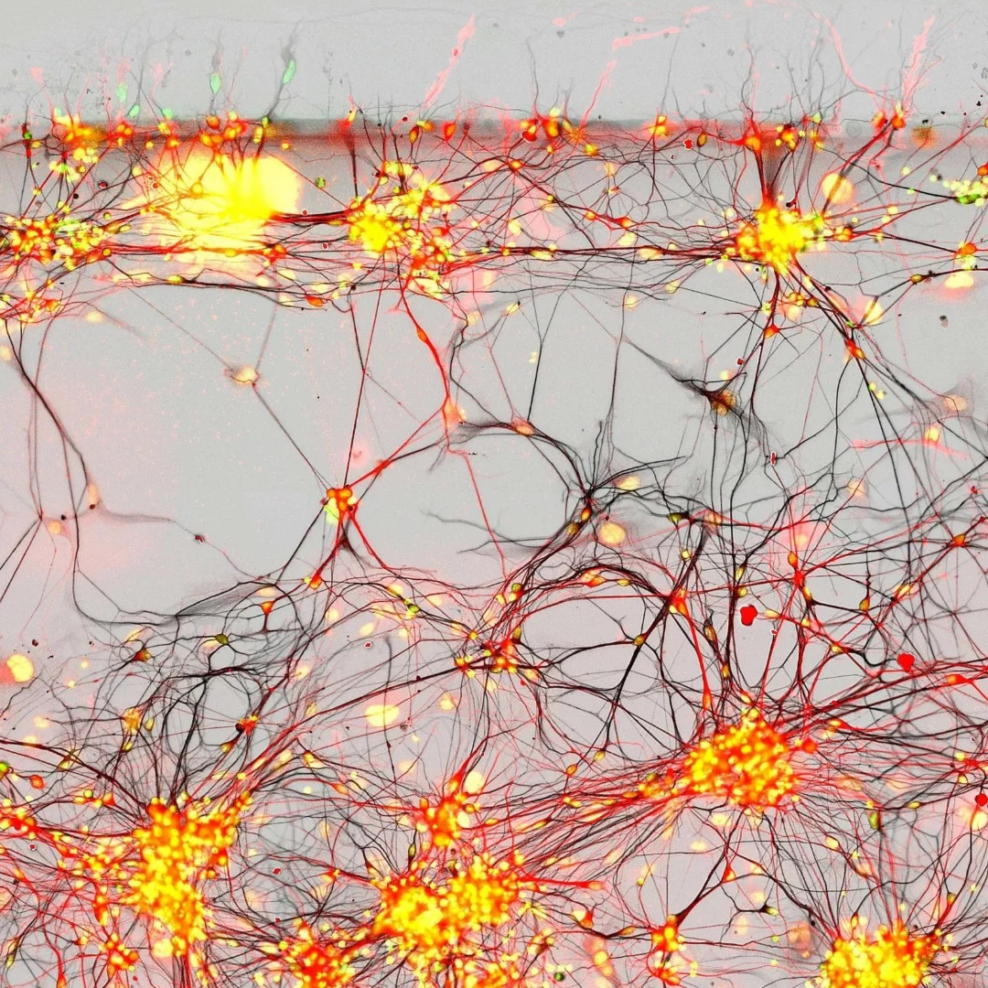 Image of Distinction: Human neurons in culture from Parkinson patients