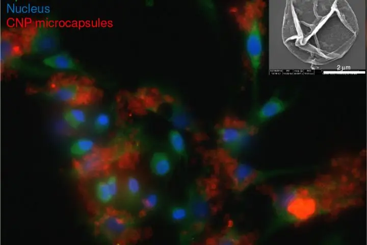 Microcapsules could be used to deliver the protein molecule CNP to the site of inflammation and tissue damage of osteoarthritis sufferers (Photo: QMUL)