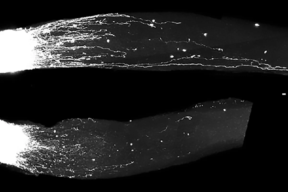 A family of RNA molecules stimulates the growth of damaged nerves, as seen in the top image